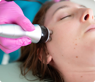 Skin Tightening Therapy