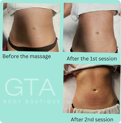 Lymphatic Massage - For Face